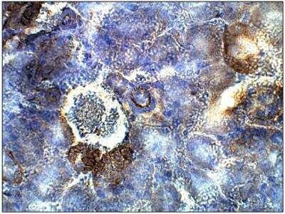 Immunohistochemistry-Paraffin: ADCY4 Antibody [NBP3-12214]