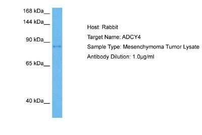 Western Blot: ADCY4 Antibody [NBP2-82567]