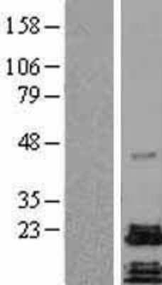 Western Blot: PACAP/ADCYAP1 Overexpression Lysate [NBL1-07328]