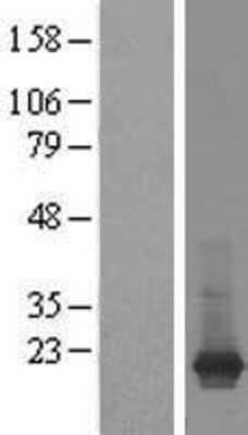 Western Blot: ARF1 Overexpression Lysate [NBL1-07649]