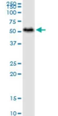 Western Blot: ADE2 Antibody (4F4) [H00010606-M01]