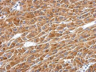 Immunohistochemistry-Paraffin: ADE2 Antibody [NBP2-15289]