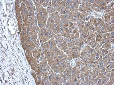 Immunohistochemistry-Paraffin: ADE2 Antibody [NBP2-15290]
