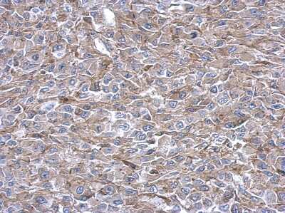 Immunohistochemistry-Paraffin: ADE2 Antibody [NBP2-15290]