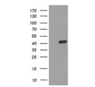 Western Blot: ADE2 Antibody (OTI1B4)Azide and BSA Free [NBP2-71610]