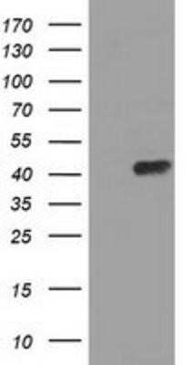 Western Blot: ADE2 Antibody (OTI1B4) [NBP2-02817]