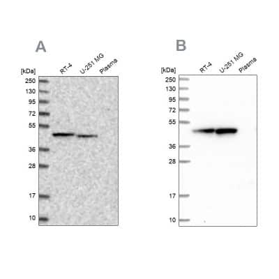 Western Blot: ADE2 Antibody [NBP1-90235]