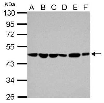 Western Blot: ADE2 Antibody [NBP2-15289]