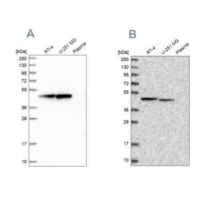 Western Blot: ADE2 Antibody [NBP2-58966]