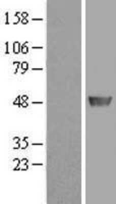 Western Blot: ADE2 Overexpression Lysate [NBP2-11447]