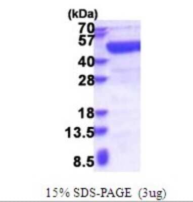 SDS-PAGE: Recombinant Human ADE2 His Protein [NBP2-51641]