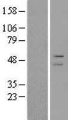 Western Blot: Perilipin-2/ADFP Overexpression Lysate [NBL1-07334]