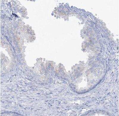 Immunohistochemistry-Paraffin: ADGB Antibody [NBP2-37881]