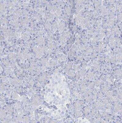 Immunohistochemistry-Paraffin: ADGB Antibody [NBP2-37881]