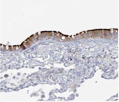 Immunohistochemistry-Paraffin: ADGB Antibody [NBP2-37881]