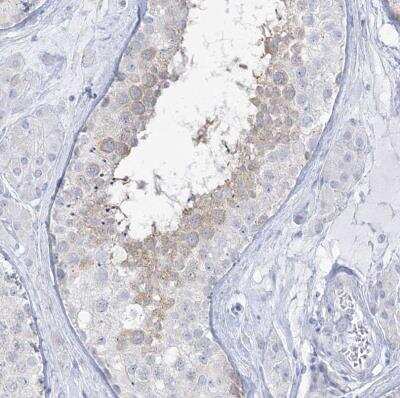 Immunohistochemistry-Paraffin: ADGB Antibody [NBP2-37881]