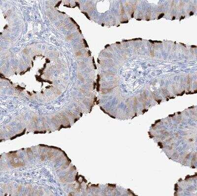 Immunohistochemistry-Paraffin: ADGB Antibody [NBP2-37881]