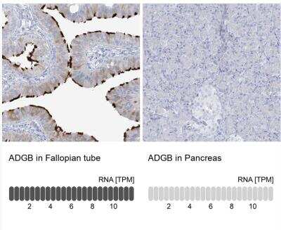 Immunohistochemistry-Paraffin: ADGB Antibody [NBP2-37881]