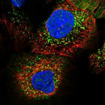 Immunocytochemistry/ Immunofluorescence: ADHFE1 Antibody [NBP1-83530]