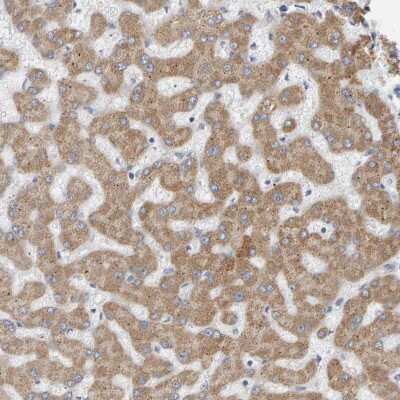 Immunohistochemistry-Paraffin: ADHFE1 Antibody [NBP1-83530]