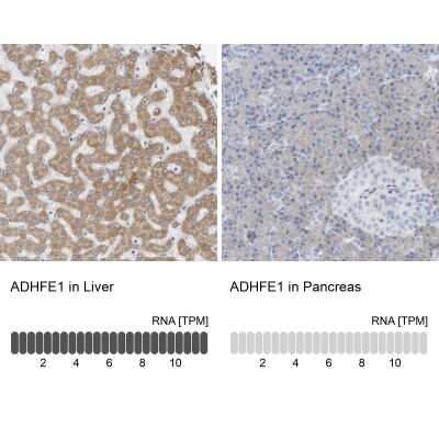 Immunohistochemistry-Paraffin: ADHFE1 Antibody [NBP1-83530]
