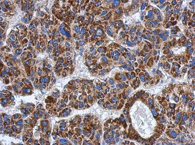 Immunohistochemistry-Paraffin: ADHFE1 Antibody [NBP2-15297]