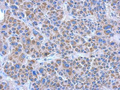 Immunohistochemistry-Paraffin: ADHFE1 Antibody [NBP2-15298]