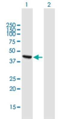 Western Blot: ADHFE1 Antibody [H00137872-B01P]