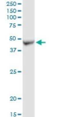 Western Blot: ADHFE1 Antibody [H00137872-D01P]