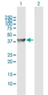 Western Blot: ADHFE1 Antibody [H00137872-D01P]
