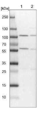 Western Blot: ADHFE1 Antibody [NBP1-83530]