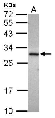 Western Blot: ADHFE1 Antibody [NBP2-15297]