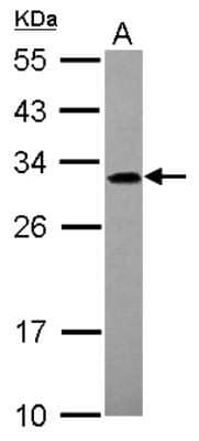 Western Blot: ADHFE1 Antibody [NBP2-15298]