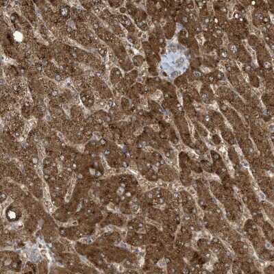 Immunohistochemistry: ADI1 Antibody [NBP2-38251]