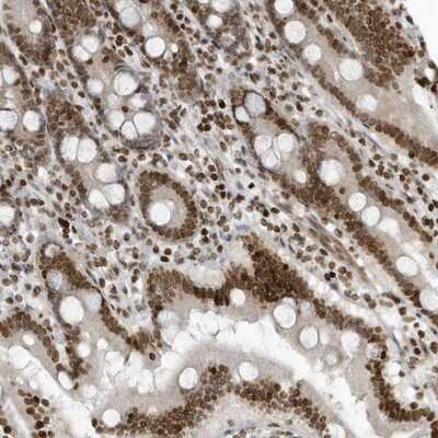 Immunohistochemistry-Paraffin: ADI1 Antibody [NBP1-89037]