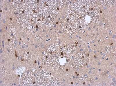 Immunohistochemistry-Paraffin: ADI1 Antibody [NBP2-15299]