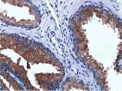 Immunohistochemistry: ADI1 Antibody (OTI5C2) - Azide and BSA Free [NBP2-71994]