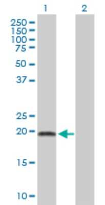 Western Blot: ADI1 Antibody [H00055256-B01P]