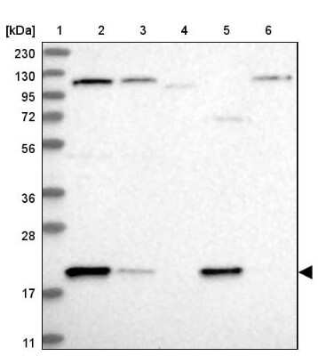 Western Blot: ADI1 Antibody [NBP1-89037]