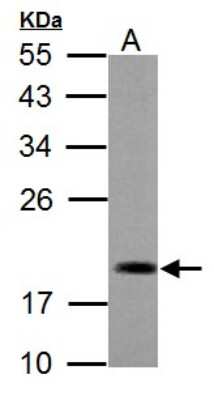 Western Blot: ADI1 Antibody [NBP2-15299]