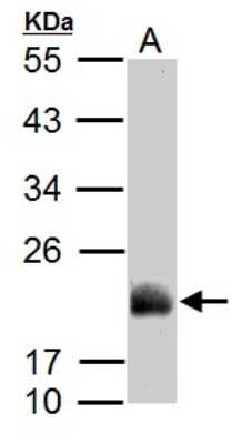 Western Blot: ADI1 Antibody [NBP2-15299]