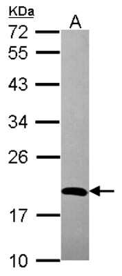 Western Blot: ADI1 Antibody [NBP2-15299]