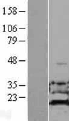 Western Blot: ADI1 Overexpression Lysate [NBL1-07340]