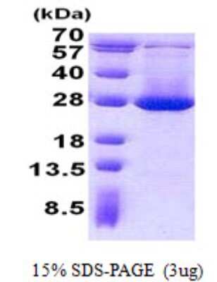 SDS-PAGE: Recombinant Human ADI1 His Protein [NBP2-22667]