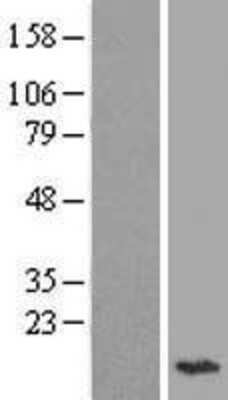 Western Blot: ADIG Overexpression Lysate [NBL1-07341]