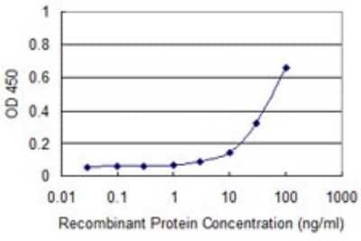 ELISA: ADK Antibody (4E7) [H00000132-M01]