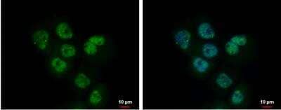 Immunocytochemistry/ Immunofluorescence: ADK Antibody [NBP1-31802]