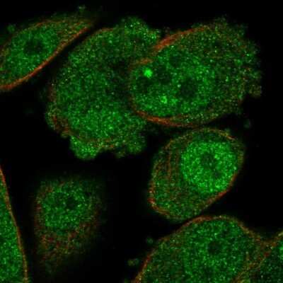 Immunocytochemistry/ Immunofluorescence: ADK Antibody [NBP1-90197]