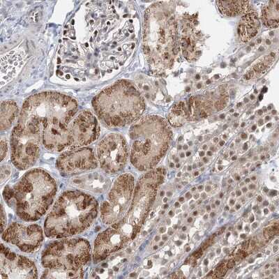 Immunohistochemistry: ADK Antibody [NBP2-38410]