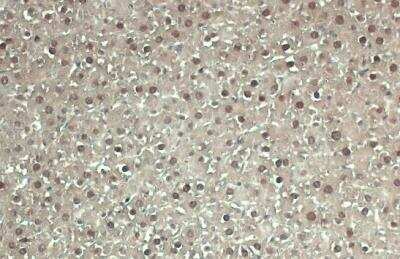 Immunohistochemistry-Paraffin: ADK Antibody [NBP2-15291]